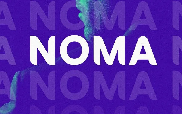 NOMA specimen from CCS Type